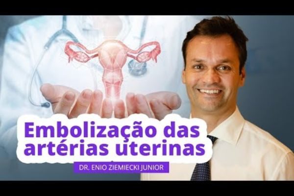 Como funciona a embolização das artérias uterinas? | Mioma Care