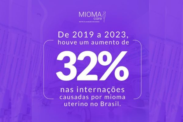 De 2019 a 2023, Houve um Aumento de 32% nas Internações Causadas por Mioma Uterino no Brasil