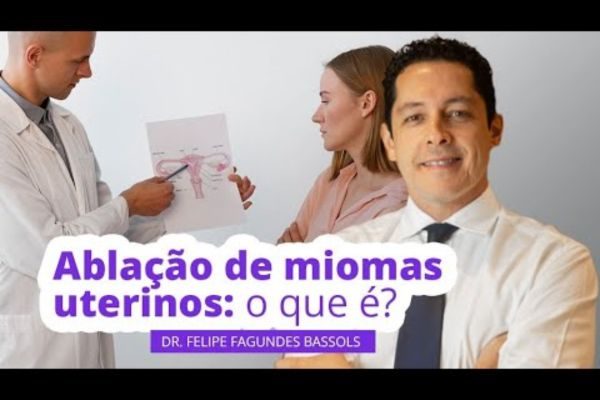 Ablação de Miomas Uterinos: O que é?