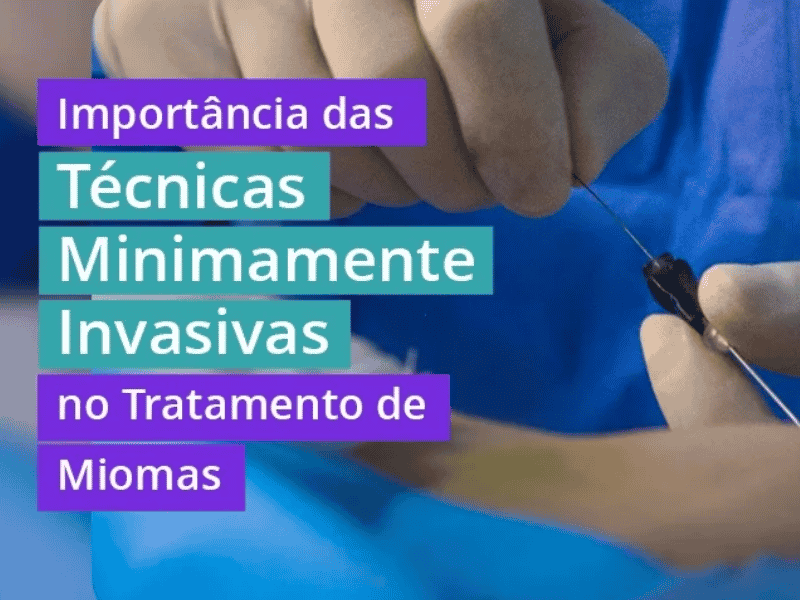 Técnicas Minimamente Invasivas no Tratamento de Miomas