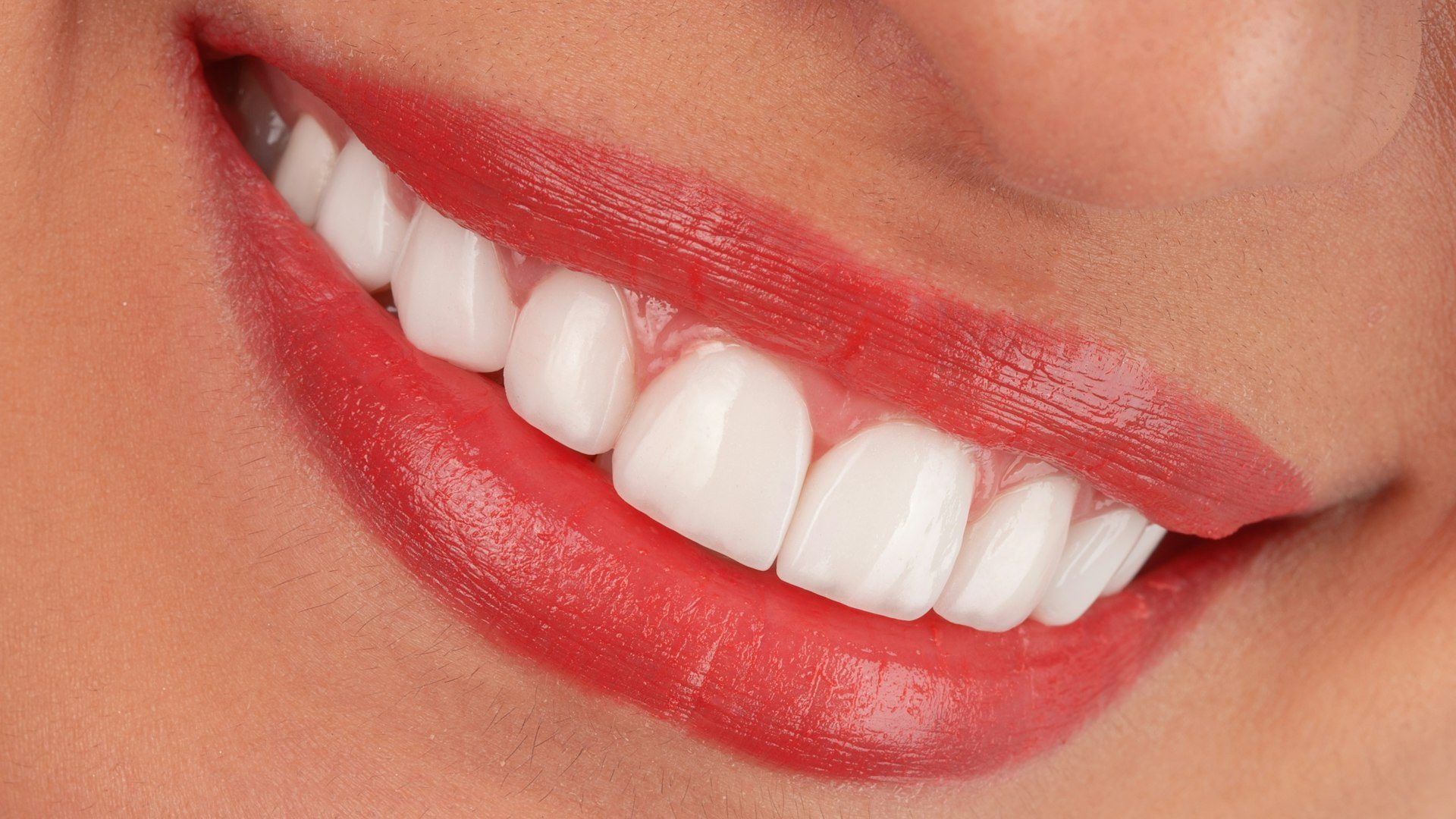 Clareamento Dental em Campinas SP: Guia Completo com Tudo que Você Precisa Saber