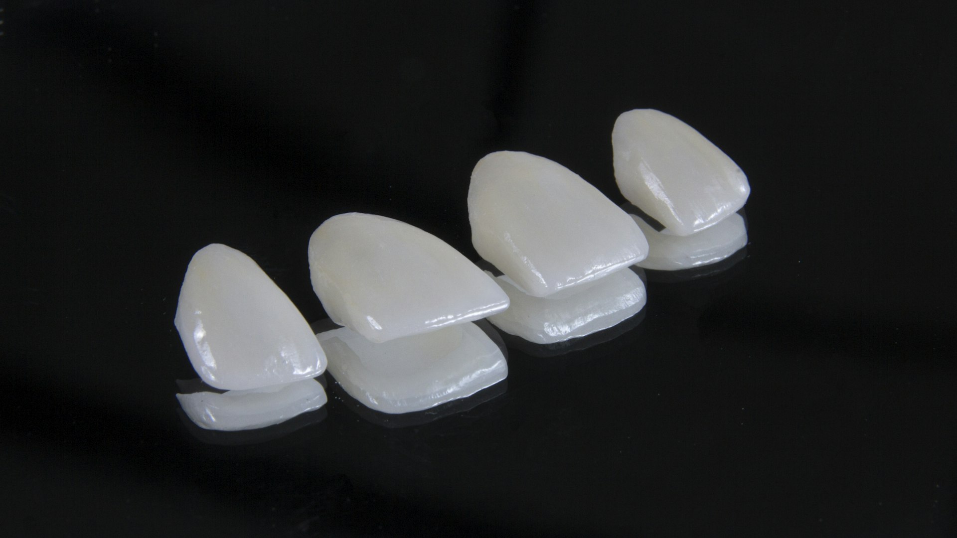 Facetas Dentais com Desgaste Mínimo: O que São e Por que Preservam Seu Dente Natural