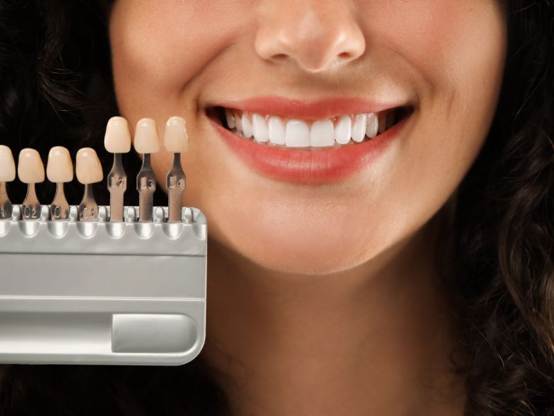 Estética Dental