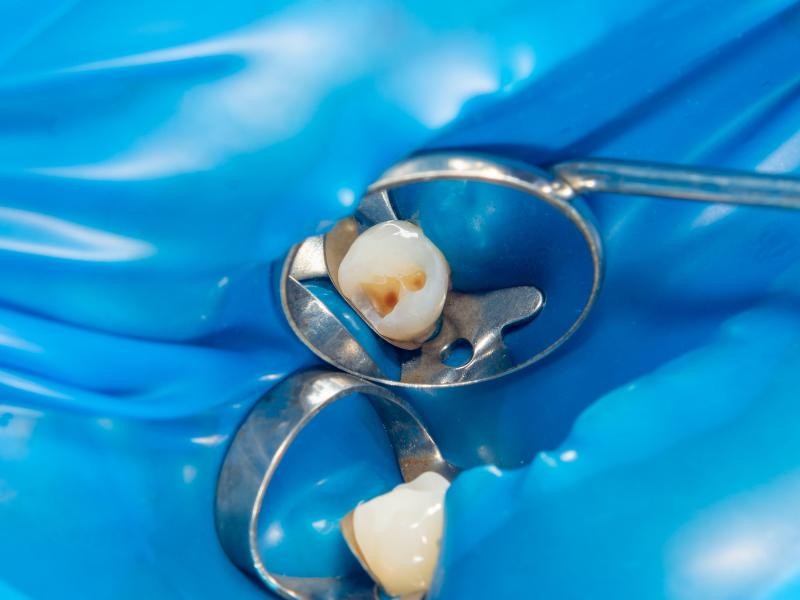 Selante Dental