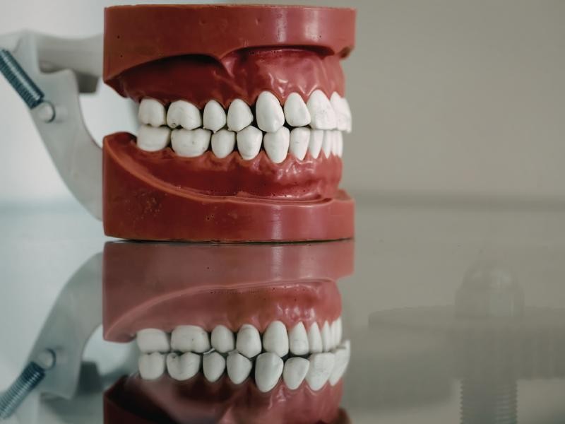 Reabilitação Estética e Funcional