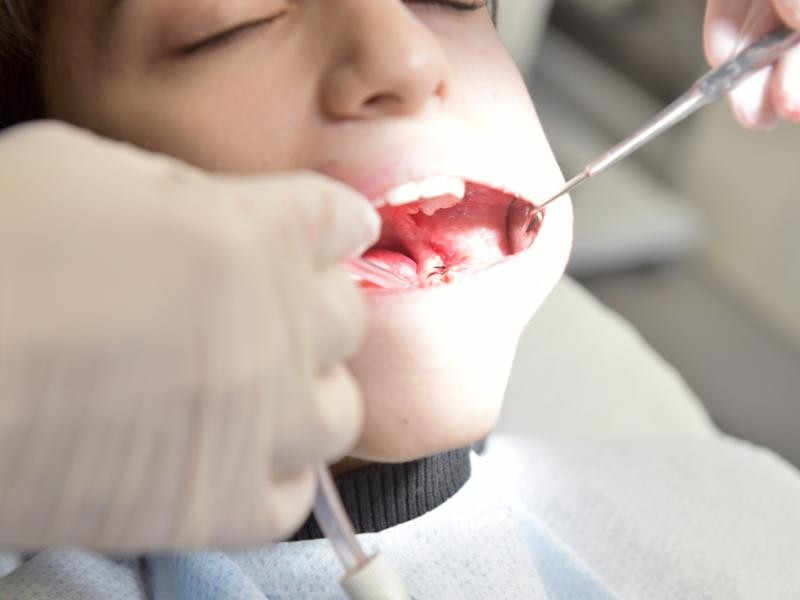Cirurgia Periodontal
