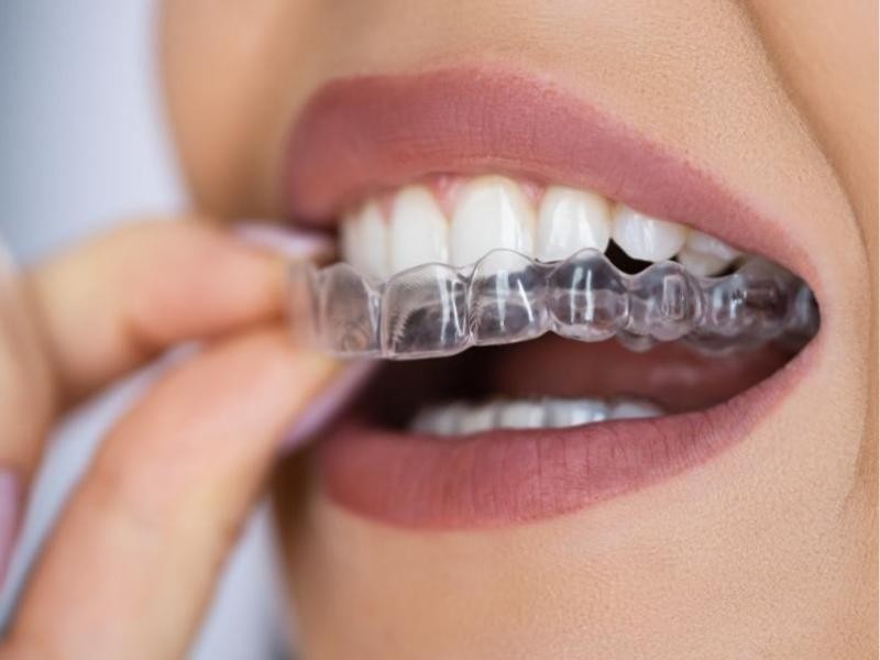 SureSmile