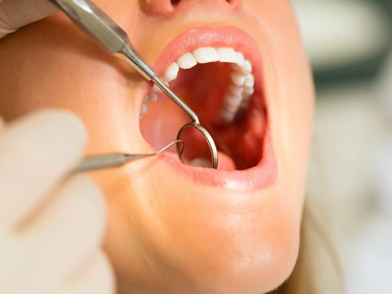 Tratamento de Erosão Dental