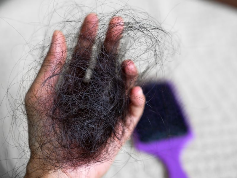 ¿Cuándo la caída del cabello es señal de un problema de salud?
