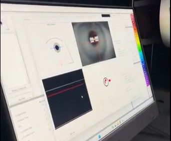 Pentacam Exame Oftalmológico