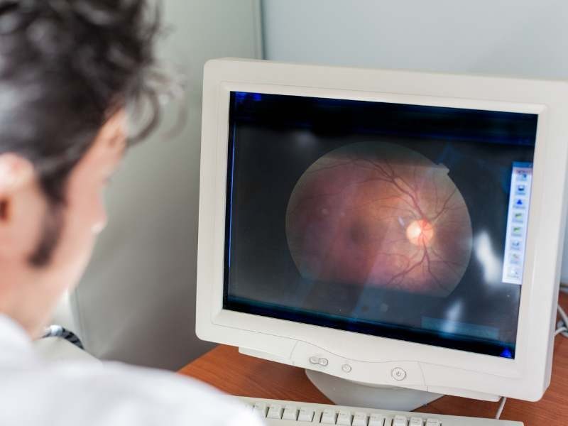 Tratamento para Retina Diabética